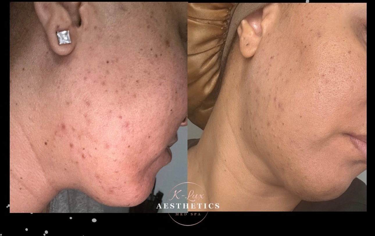 Turmeric & Kojic Acid Skincare Set